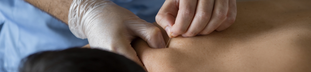 physical-therapy-clinic-dry-needling-kinect-physiotherapy-knightdale-wake-forest-nc