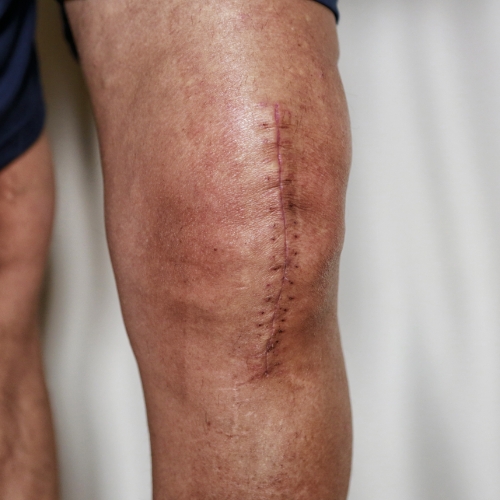 physical-therapy-clinic-post-operative-pain-kinect-physiotherapy-knightdale-wake-forest-nc